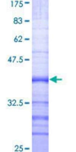 Novus Biologicals Recombinant Human BMP2K GST (N-Term) Protein 25 &mu;g | Buy Online | Novus Biologicals&trade; | Fisher Scientific