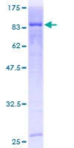 Novus Biologicals Recombinant Human CARF/CDKN2AIP GST (N-Term) Protein 10 &mu;g | Buy Online | Novus Biologicals&trade; | Fisher Scientific