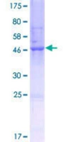 Novus Biologicals Recombinant Human ANKRD10 GST (N-Term) Protein 25 &mu;g | Buy Online | Novus Biologicals&trade; | Fisher Scientific