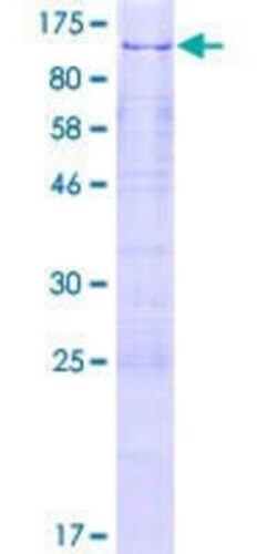Novus Biologicals Recombinant Human SUHW3 GST (N-Term) Protein 2 &mu;g | Buy Online | Novus Biologicals&trade; | Fisher Scientific