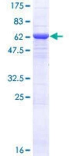Novus Biologicals Recombinant Human VPS50 GST (N-Term) Protein 25 &mu;g | Buy Online | Novus Biologicals&trade; | Fisher Scientific