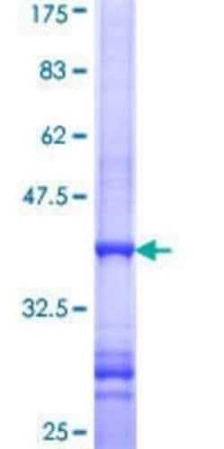 Novus Biologicals Recombinant Human VPS50 GST (N-Term) Protein 10 &mu;g | Buy Online | Novus Biologicals&trade; | Fisher Scientific