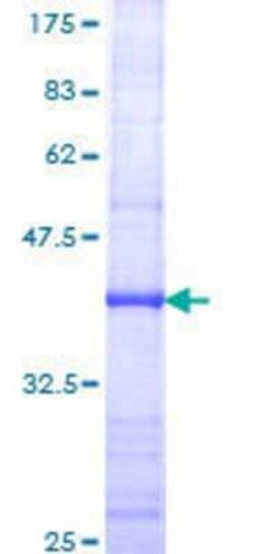 Novus Biologicals Recombinant Human KIF16B GST (N-Term) Protein 10 &mu;g | Buy Online | Novus Biologicals&trade; | Fisher Scientific
