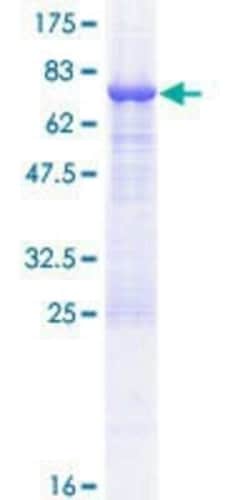 Novus Biologicals Recombinant Human TASP1 GST (N-Term) Protein 25 &mu;g | Buy Online | Novus Biologicals&trade; | Fisher Scientific