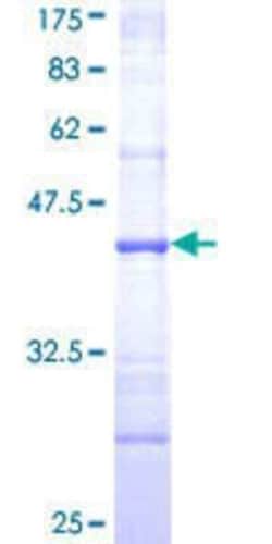 Novus Biologicals Recombinant Human STAP2 GST (N-Term) Protein 10 &mu;g | Buy Online | Novus Biologicals&trade; | Fisher Scientific