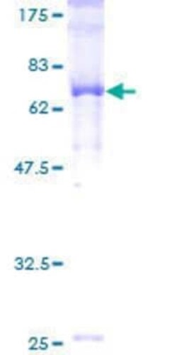 Novus Biologicals Recombinant Human THUMPD1 GST (N-Term) Protein 25 &mu;g | Buy Online | Novus Biologicals&trade; | Fisher Scientific
