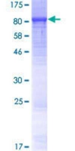 Novus Biologicals Recombinant Human LRRC40 GST (N-Term) Protein 10 &mu;g | Buy Online | Novus Biologicals&trade; | Fisher Scientific