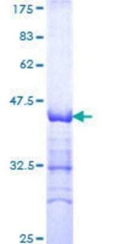 Novus Biologicals Recombinant Human DEPDC1A GST (N-Term) Protein 25 &mu;g | Buy Online | Novus Biologicals&trade; | Fisher Scientific