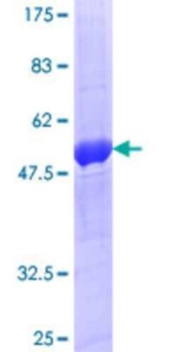Novus Biologicals Recombinant Human Rab20 GST (N-Term) Protein 10 &mu;g | Buy Online | Novus Biologicals&trade; | Fisher Scientific