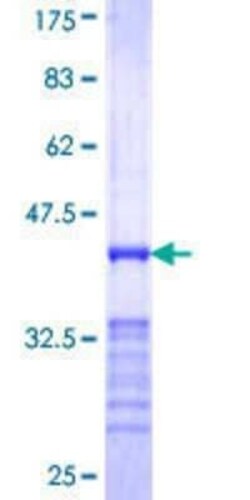 Novus Biologicals Recombinant Human Rab20 GST (N-Term) Protein 10 &mu;g | Buy Online | Novus Biologicals&trade; | Fisher Scientific