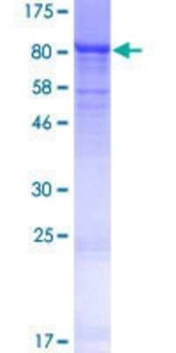 Novus Biologicals Recombinant Human ZNF416 GST (N-Term) Protein 25 &mu;g | Buy Online | Novus Biologicals&trade; | Fisher Scientific