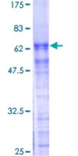 Novus Biologicals Recombinant Human FNBP3 GST (N-Term) Protein 25 &mu;g | Buy Online | Novus Biologicals&trade; | Fisher Scientific