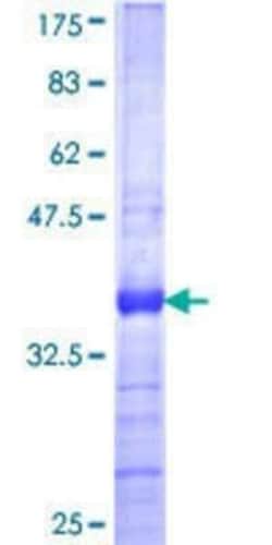 Novus Biologicals Recombinant Human ZNF446 GST (N-Term) Protein 25 &mu;g | Buy Online | Novus Biologicals&trade; | Fisher Scientific