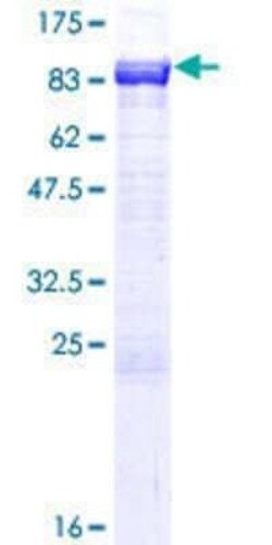 Novus Biologicals Recombinant Human NPLOC4 GST (N-Term) Protein 25 &mu;g | Buy Online | Novus Biologicals&trade; | Fisher Scientific