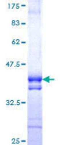 Novus Biologicals Recombinant Human NPLOC4 GST (N-Term) Protein 10 &mu;g | Buy Online | Novus Biologicals&trade; | Fisher Scientific