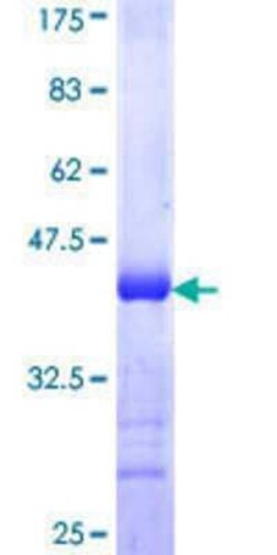 Novus Biologicals Recombinant Human Mitofusin 1 GST (N-Term) Protein 25 &mu;g | Buy Online | Novus Biologicals&trade; | Fisher Scientific