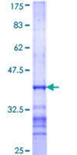 Novus Biologicals Recombinant Human SCYL2 GST (N-Term) Protein 25 &mu;g | Buy Online | Novus Biologicals&trade; | Fisher Scientific