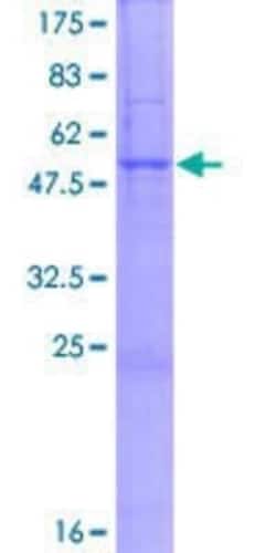 Novus Biologicals Recombinant Human TRMU GST (N-Term) Protein 10 &mu;g | Buy Online | Novus Biologicals&trade; | Fisher Scientific