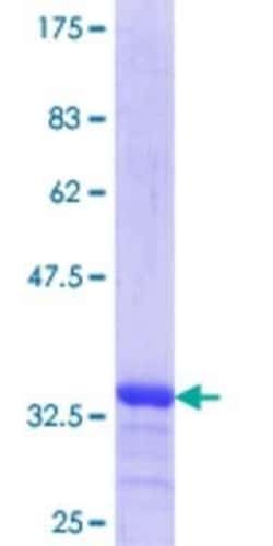 Novus Biologicals Recombinant Human VAC14 GST (N-Term) Protein 25 &mu;g | Buy Online | Novus Biologicals&trade; | Fisher Scientific