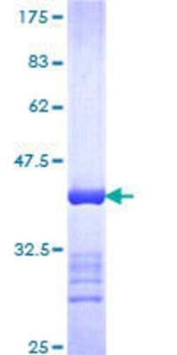 Novus Biologicals Recombinant Human N4BP2 GST (N-Term) Protein 25 &mu;g | Buy Online | Novus Biologicals&trade; | Fisher Scientific