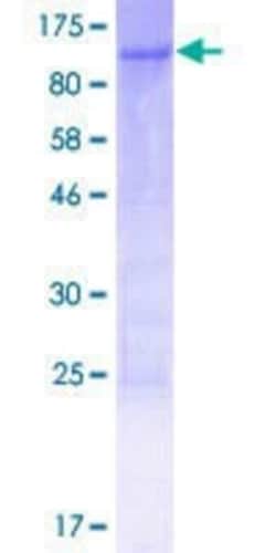 Novus Biologicals Recombinant Human ZFP64 GST (N-Term) Protein 10 &mu;g | Buy Online | Novus Biologicals&trade; | Fisher Scientific