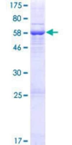 Novus Biologicals Recombinant Human FLJ10769 GST (N-Term) Protein 10 &mu;g | Buy Online | Novus Biologicals&trade; | Fisher Scientific