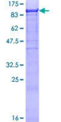 Novus Biologicals Recombinant Human CHFR GST (N-Term) Protein 10 &mu;g | Buy Online | Novus Biologicals&trade; | Fisher Scientific