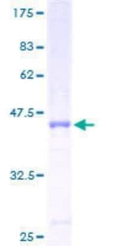 Novus Biologicals Recombinant Human COA1 GST (N-Term) Protein 10 &mu;g | Buy Online | Novus Biologicals&trade; | Fisher Scientific