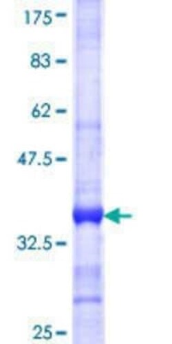 Novus Biologicals Recombinant Human NUP133 GST (N-Term) Protein 25 &mu;g | Buy Online | Novus Biologicals&trade; | Fisher Scientific
