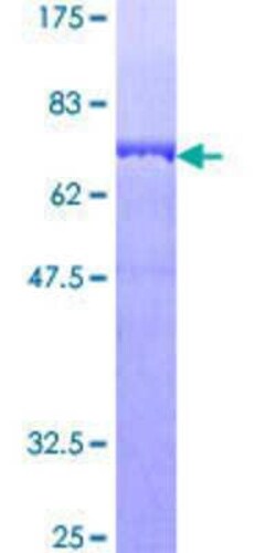 Novus Biologicals Recombinant Human Septin-11 GST (N-Term) Protein 10 &mu;g | Buy Online | Novus Biologicals&trade; | Fisher Scientific