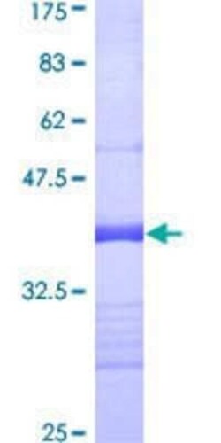 Novus Biologicals Recombinant Human Septin-11 GST (N-Term) Protein 10 &mu;g | Buy Online | Novus Biologicals&trade; | Fisher Scientific