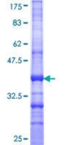 Novus Biologicals Recombinant Human SEC3 GST (N-Term) Protein 10 &mu;g | Buy Online | Novus Biologicals&trade; | Fisher Scientific