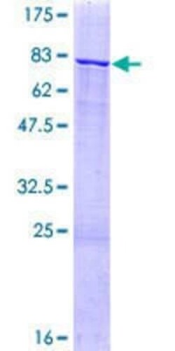 Novus Biologicals Recombinant Human ZNF83 GST (N-Term) Protein 10 &mu;g | Buy Online | Novus Biologicals&trade; | Fisher Scientific