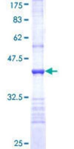 Novus Biologicals Recombinant Human ZNF83 GST (N-Term) Protein 10 &mu;g | Buy Online | Novus Biologicals&trade; | Fisher Scientific