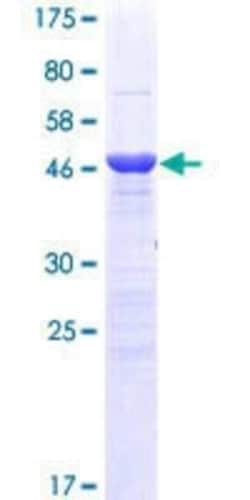 R&D Systems&trade;&nbsp;Recombinant Human MBD5 GST (N-Term) Protein