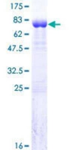 Novus Biologicals Recombinant Human NY-REN-50 antigen GST (N-Term) Protein 25 &mu;g | Buy Online | Novus Biologicals&trade; | Fisher Scientific