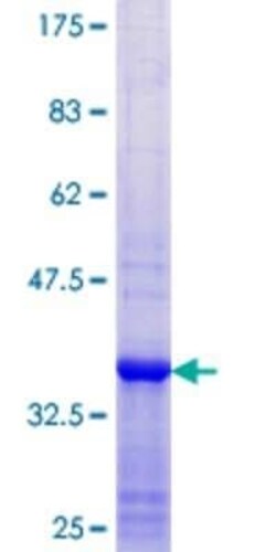 Novus Biologicals Recombinant Human RIOK2 GST (N-Term) Protein 10 &mu;g | Buy Online | Novus Biologicals&trade; | Fisher Scientific