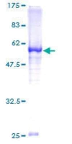 Novus Biologicals Recombinant Human MCTP2 GST (N-Term) Protein 25 &mu;g | Buy Online | Novus Biologicals&trade; | Fisher Scientific