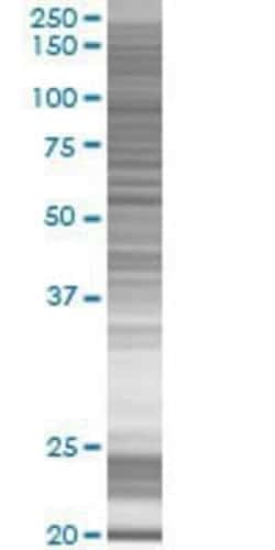 Novus Biologicals FGD6 293T Cell Transient Overexpression Lysate 0.1 mL | Buy Online | Novus Biologicals&trade; | Fisher Scientific