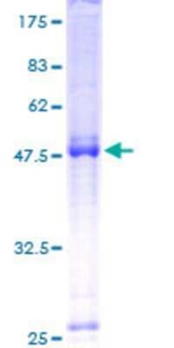 Novus Biologicals Recombinant Human DEPDC1B GST (N-Term) Protein 10 &mu;g | Buy Online | Novus Biologicals&trade; | Fisher Scientific
