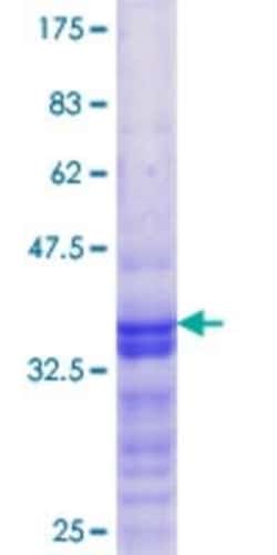 Novus Biologicals Recombinant Human DEPDC1B GST (N-Term) Protein 10 &mu;g | Buy Online | Novus Biologicals&trade; | Fisher Scientific