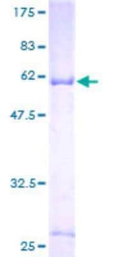 Novus Biologicals Recombinant Human ChGn GST (N-Term) Protein 25 &mu;g | Buy Online | Novus Biologicals&trade; | Fisher Scientific