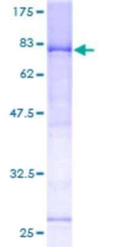 Novus Biologicals Recombinant Human LRIF1 GST (N-Term) Protein 10 &mu;g | Buy Online | Novus Biologicals&trade; | Fisher Scientific