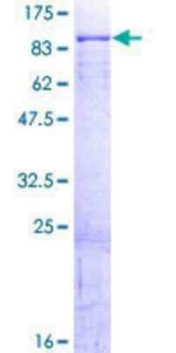 Novus Biologicals Recombinant Human Dcp1a GST (N-Term) Protein 2 &mu;g | Buy Online | Novus Biologicals&trade; | Fisher Scientific