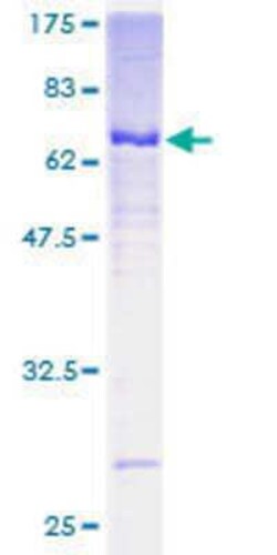 Novus Biologicals Recombinant Human Centaurin alpha 2 GST (N-Term) Protein 25 &mu;g | Buy Online | Novus Biologicals&trade; | Fisher Scientific