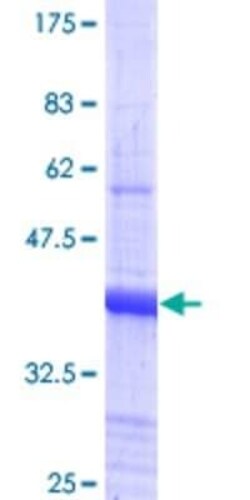 Novus Biologicals Recombinant Human Hairless GST (N-Term) Protein 10 &mu;g | Buy Online | Novus Biologicals&trade; | Fisher Scientific