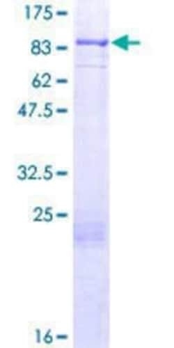 Novus Biologicals Recombinant Human FOXJ2 GST (N-Term) Protein 25 &mu;g | Buy Online | Novus Biologicals&trade; | Fisher Scientific