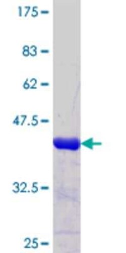 Novus Biologicals Recombinant Human FOXJ2 GST (N-Term) Protein 25 &mu;g | Buy Online | Novus Biologicals&trade; | Fisher Scientific
