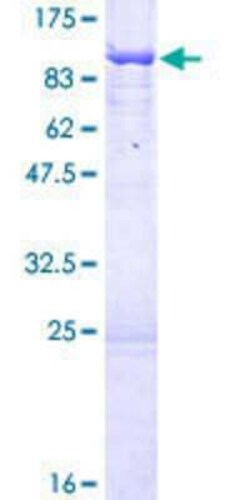 Novus Biologicals&trade;&nbsp;Recombinant Human UTP6 GST (N-Term) Protein
