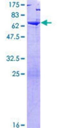 Novus Biologicals Recombinant Human TSNAXIP1 GST (N-Term) Protein 10 &mu;g | Buy Online | Novus Biologicals&trade; | Fisher Scientific